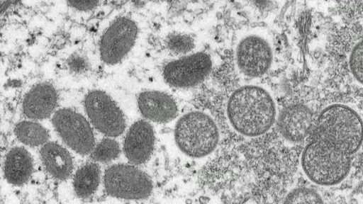 Die Affenpockenviren unter einem Mirkoskop. 
