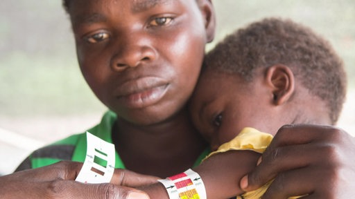 Afrikanerin mit einem unterernährten Kind auf dem Arm.