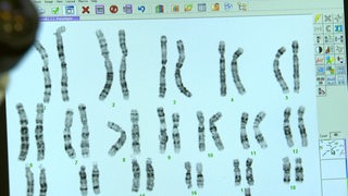 Eine Abbildung mehrerer Chromosomen.
