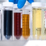 Gefäße mit Proben stehen in einem Absorptionsversuchsstand für Abwässer 