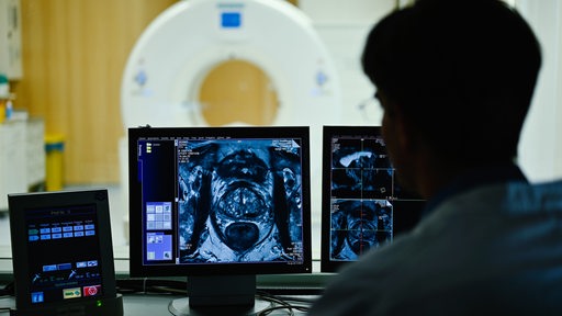 Ein Mediziner beobachtet auf einem Monitor das Querschnittsbild einer Prostata.