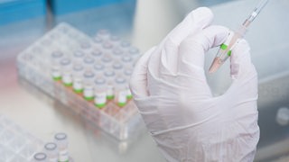 Eine biologisch-technische Assistentin bereitet PCR-Tests auf das Corona-Virus von Patienten im PCR-Labor vom Niedersächsischen Landesgesundheitsamt (NLGA) für die Analyse vor. 