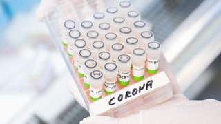 Eine biologisch-technische Assistentin zeigt aufbereitete PCR-Tests auf das Corona-Virus von Patienten im PCR-Labor 