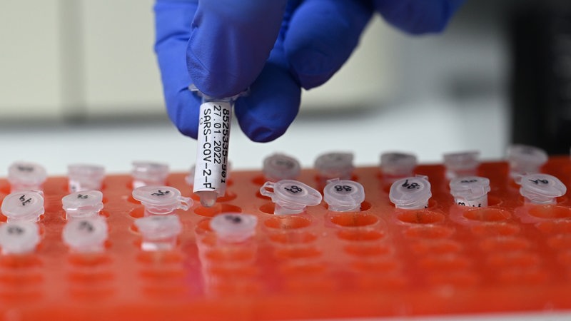 PCR-Tests im Labor. 