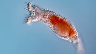 Lichtmikroskopische Aufnahmen von Rädertierchen