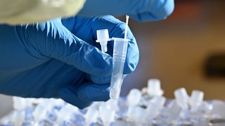 Ein Teststäbchen wird nach einem Nasenabstrich in ein Röhrchen mit einer Testlösung getaucht