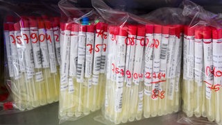 PCR-Tests von Patienten liegen im Labor Nordlab in einem Kühlschrank. 