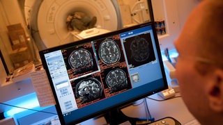 Bildschirm mit Aufnahmen eines MRT vom Gehirn des Probanden, der im Hintergrund im MRT-Gerät liegt.