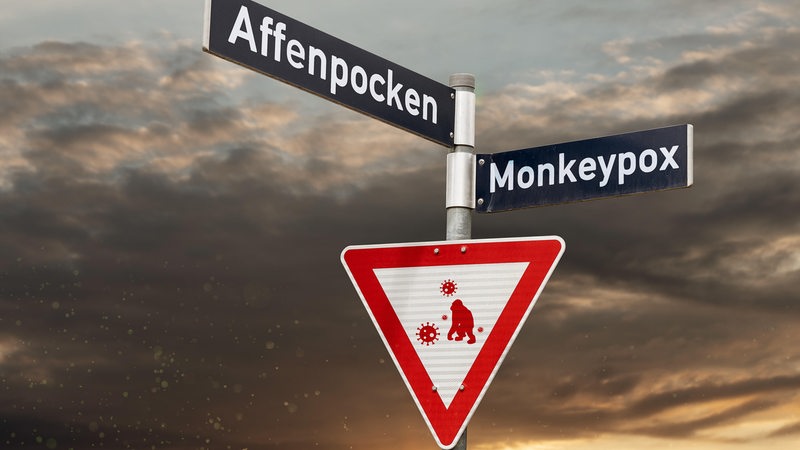 Auf einem roten Warnschild steht "Affenpocken". In Niedersachsen wurde der erste Fall nachgewiesen.