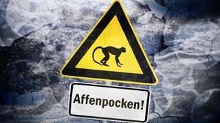 Warnschild vor Affenpocken