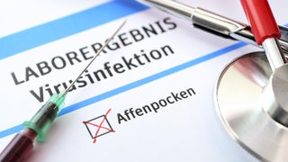 Auf einem Laborbericht ist das Ergebnis "Affenpocken" angekreuzt.