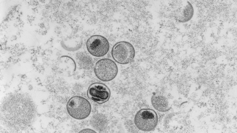 Affenpocken-Viren unter dem Elektronenrastermikroskop (Archivbild)
