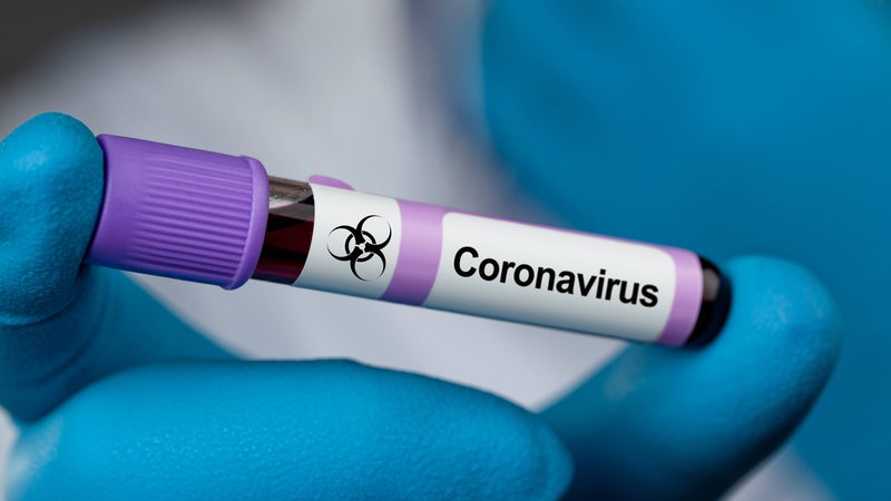 Ein Röhrchen mit einer Blutprobe. Darauf steht "Coronavirus".