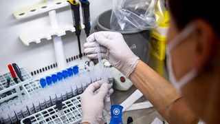 Eine Labormitarbeiterin führt Corona-Tests durch