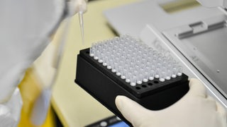 Ein Labormitarbeiter hält Teströhrchen
