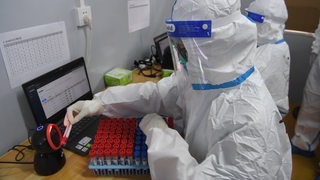 Menschen in medizinischer Schutzkleidung arbeiten mit Teströhrchen