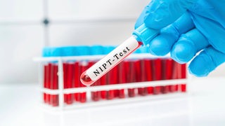Ein NIPT-Bluttest