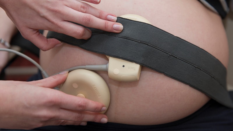 Zwischen elastischem Gurt und Bauch einer Schwangeren wird ein Schallknopf zur Messung der Herzfrequenz und der Wehen angebracht. (Archivbild)