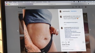Ein Bildschirm, auf dem ein Beitrag auf "Instagram" geöffnet ist. Der Beitrag zeigt den Bauch einer Frau.