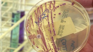 Eine Petrischale mit bakteriellen Zellkulturen in einem Labor
