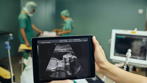 Hände halten ein Tablet in einem OP, das einen Ultraschall eines Babys zeigt