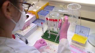 Eine Labormitarbeiterin ist dabei, Proben per PCR-Test auf das Coronavirus zu untersuchen.