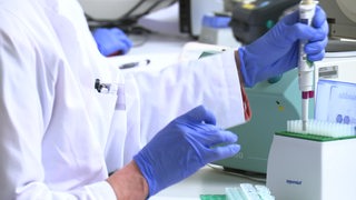 Mehrere Proben werden in einem Labor bearbeitet.