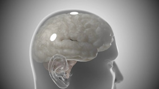 Eine Grafik eines transparenten Schädels und dessen Gehirns