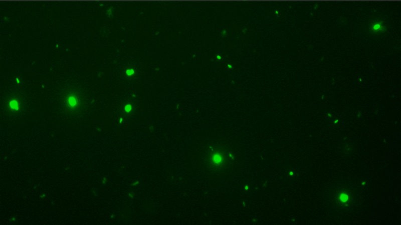 Grüne helle Punkte unter einem Mikroskop