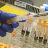 In einem medizinischen Labor bearbeitet ein Mensch Serumröhrchen mit Blutentnahmen von Patienten. 